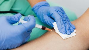 prelievo sangue - pexels -automotore